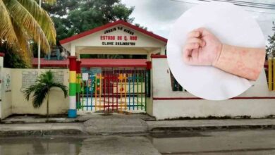 Kinder en Tulum suspende clases por brote de enfermedad manos, pies y boca