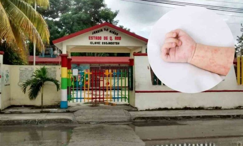 Kinder en Tulum suspende clases por brote de enfermedad manos, pies y boca