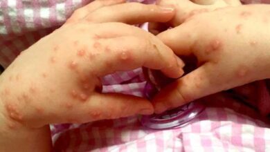 Virus Coxsackie